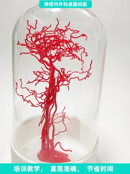 Модел съдове на главата и шията Модел главоболие артерия висока инжекция 3D модел на кръвоносните съдове на целия мозък Внутричерепная съдова мрежа